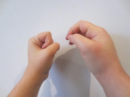 El angioedema hereditario es una enfermedad hereditaria caracterizada por la presencia de hinchazón e inflamación en diferentes partes del cuerpo, como por ejemplo las manos. Imagen: Emel Aygören-Pürsün.